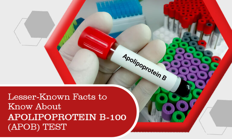 Lesser-Known Facts To Know About Apolipoprotein B-100 (Apob) Test ...