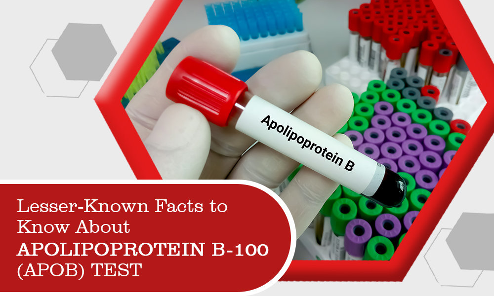 Lesser-Known Facts to Know About Apolipoprotein B-100 (Apob) Test